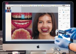 3D стоматологія: цифрові технології в стоматології