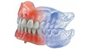 3D стоматологія: цифрові технології в стоматології